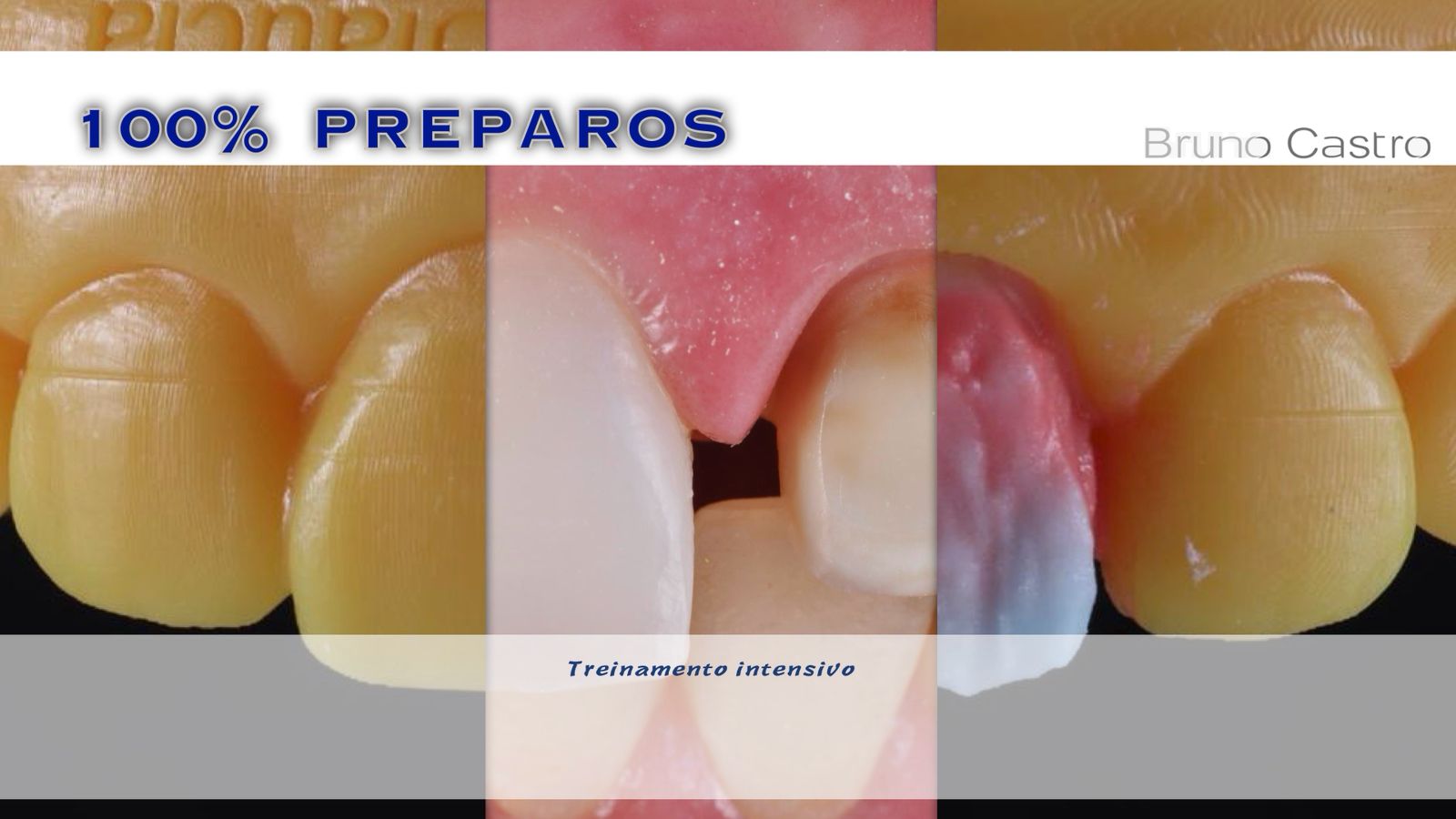 Curso VIP 100% Preparos — Treinamento Intensivo
